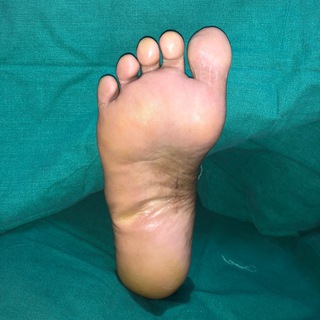 Diabetic Foot Surgery Group