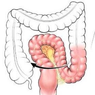 Чат о Долихосигме
